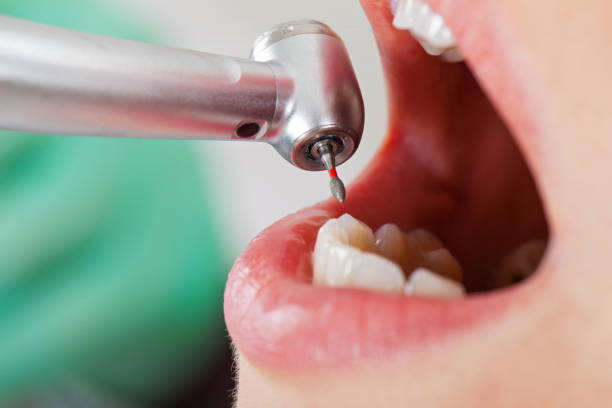 Best Emergency Treatment for Jaw Pain or Injury in Lake Cassidy, WA